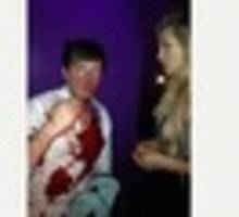 Police launch formal investigation into Bristol club attack on Josie's brother